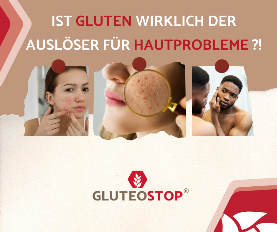Kann Gluten der Auslöser für Hautprobleme sein?
