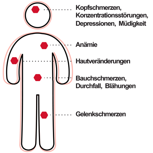 Glutensensitivität: Was ist das?