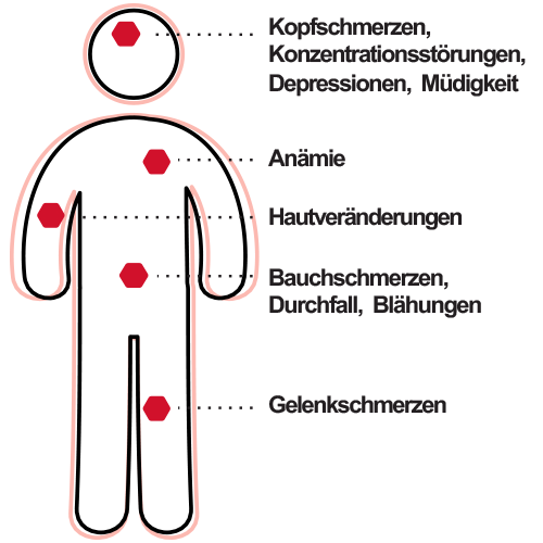 beschwerden-1e7bbiTwuWvu0M